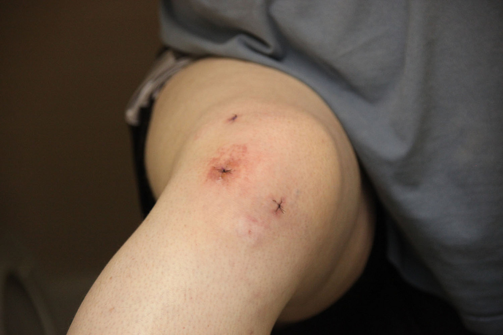kijkoperatie_knie